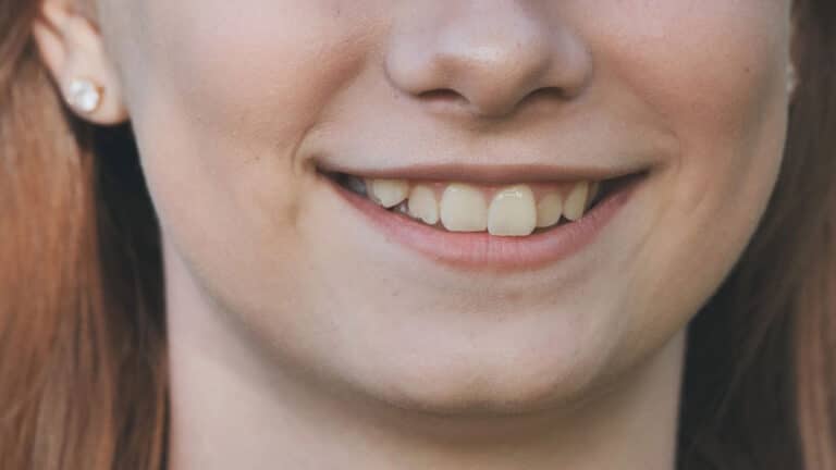 Woman Smiling With Crooked Teeth